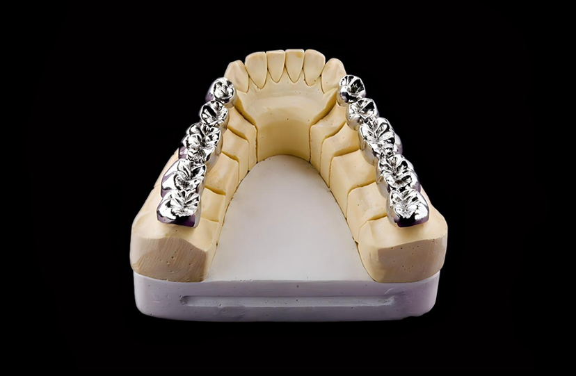 Full Cast Metal Crown